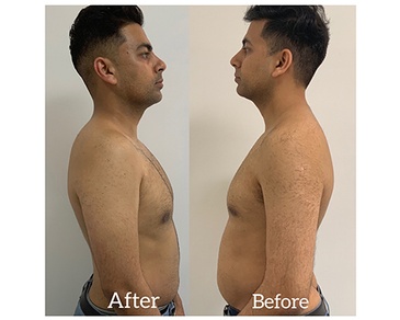 Mihir Body Slimming Treatment in Richmond, BC